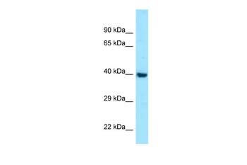MC1R Rabbit Polyclonal Antibody
