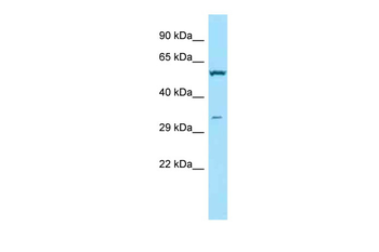 TPMT Rabbit Polyclonal Antibody