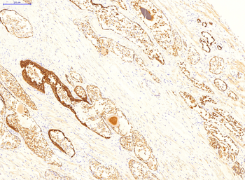 DPP4 Rabbit Polyclonal Antibody