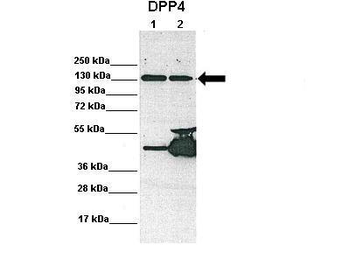 DPP4 Rabbit Polyclonal Antibody
