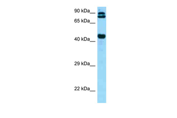 DPP4 Rabbit Polyclonal Antibody