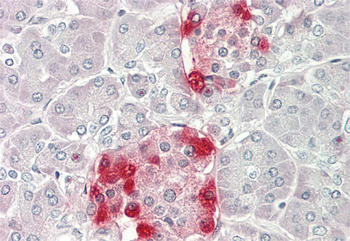 GDF5 Rabbit Polyclonal Antibody