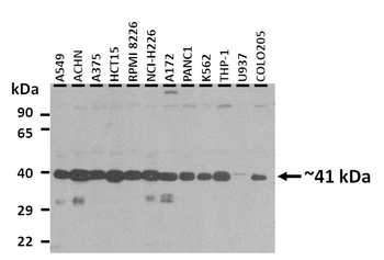 ADIPOR1 Rabbit Polyclonal Antibody