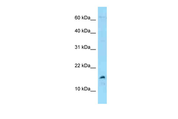 MDK Rabbit Polyclonal Antibody