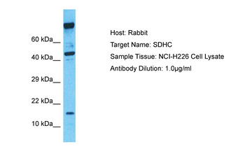 SDHC Rabbit Polyclonal Antibody