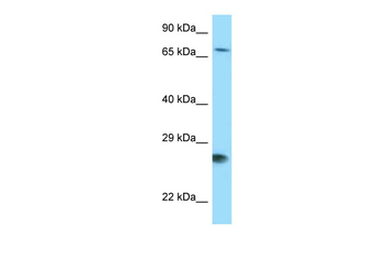 BAG1 Rabbit Polyclonal Antibody