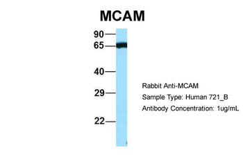 MCAM Rabbit Polyclonal Antibody