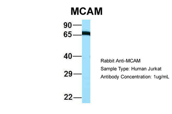 MCAM Rabbit Polyclonal Antibody