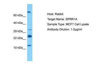 SPRR1A Rabbit Polyclonal Antibody