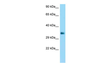 FCGR2B Rabbit Polyclonal Antibody