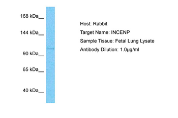 INCENP Rabbit Polyclonal Antibody