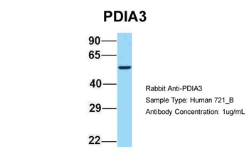 PDIA3 Rabbit Polyclonal Antibody
