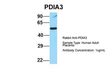 PDIA3 Rabbit Polyclonal Antibody