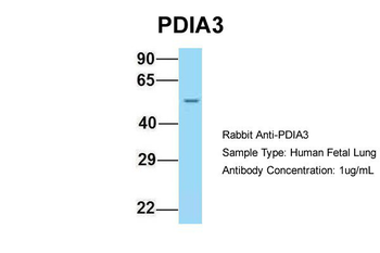 PDIA3 Rabbit Polyclonal Antibody