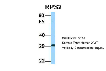 RPS2 Rabbit Polyclonal Antibody