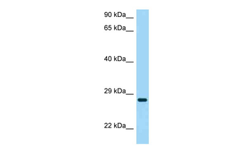 CD37 Rabbit Polyclonal Antibody