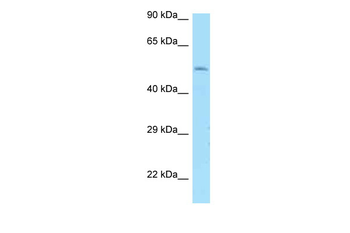 DRD1 Rabbit Polyclonal Antibody