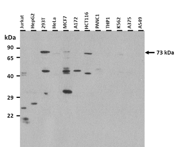 IDUA Rabbit Polyclonal Antibody