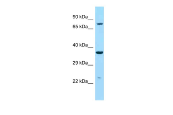 IDUA Rabbit Polyclonal Antibody