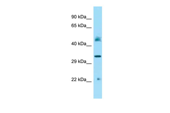 IDUA Rabbit Polyclonal Antibody