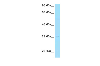 LAT2 Rabbit Polyclonal Antibody