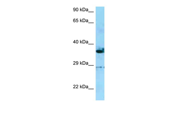 INF2 Rabbit Polyclonal Antibody