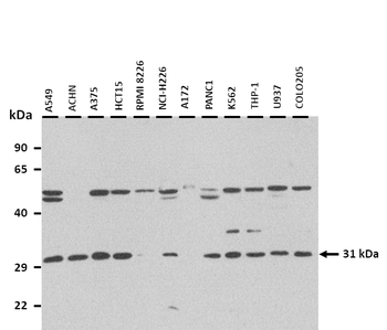 TNFAIP6 Rabbit Polyclonal Antibody