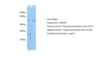 TNFAIP6 Rabbit Polyclonal Antibody