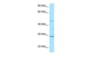 TNFAIP6 Rabbit Polyclonal Antibody