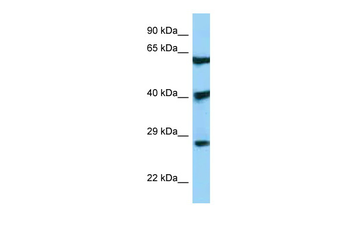 DKK3 Rabbit Polyclonal Antibody