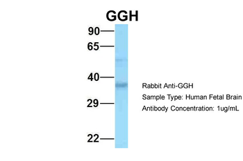 GGH Rabbit Polyclonal Antibody