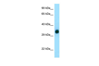 GGH Rabbit Polyclonal Antibody