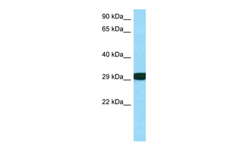 RPS3 Rabbit Polyclonal Antibody