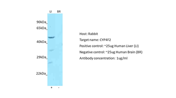 CYP4F2 Rabbit Polyclonal Antibody