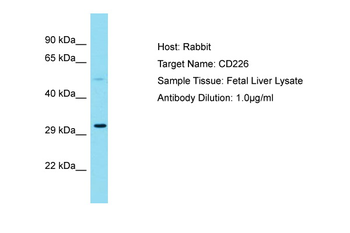 CD226 Rabbit Polyclonal Antibody