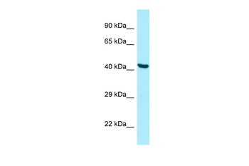 PANK2 Rabbit Polyclonal Antibody
