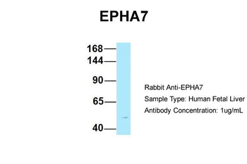 EPHA7 Rabbit Polyclonal Antibody