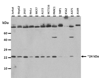 FGF18 Rabbit Polyclonal Antibody