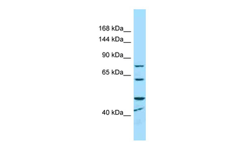 MCPH1 Rabbit Polyclonal Antibody