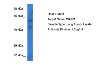 WISP1 Rabbit Polyclonal Antibody