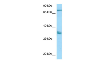 KIR2DS2 Rabbit Polyclonal Antibody