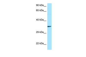 QKI Rabbit Polyclonal Antibody