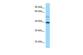 STRA8 Rabbit Polyclonal Antibody