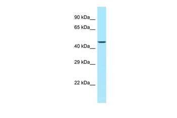 LIMS1 Rabbit Polyclonal Antibody
