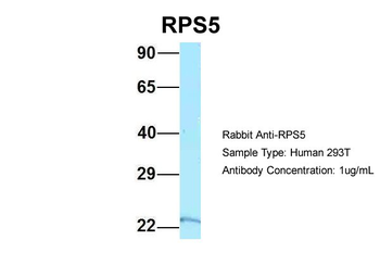 RPS5 Rabbit Polyclonal Antibody