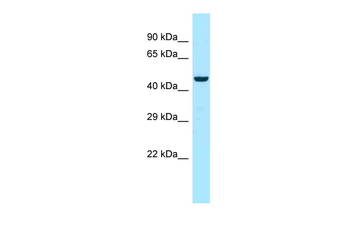 MYOT Rabbit Polyclonal Antibody