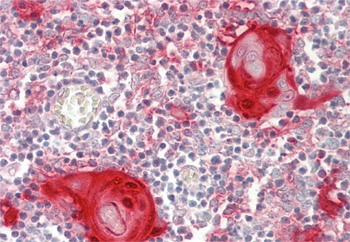 LGALS7 Rabbit Polyclonal Antibody