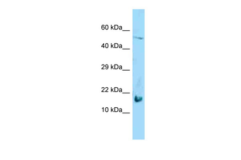 LGALS7 Rabbit Polyclonal Antibody
