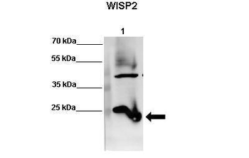 WISP2 Rabbit Polyclonal Antibody