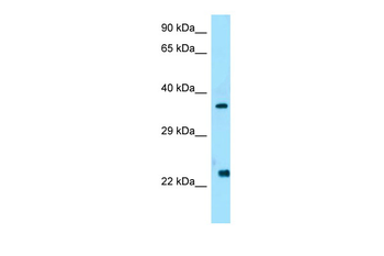 WISP2 Rabbit Polyclonal Antibody